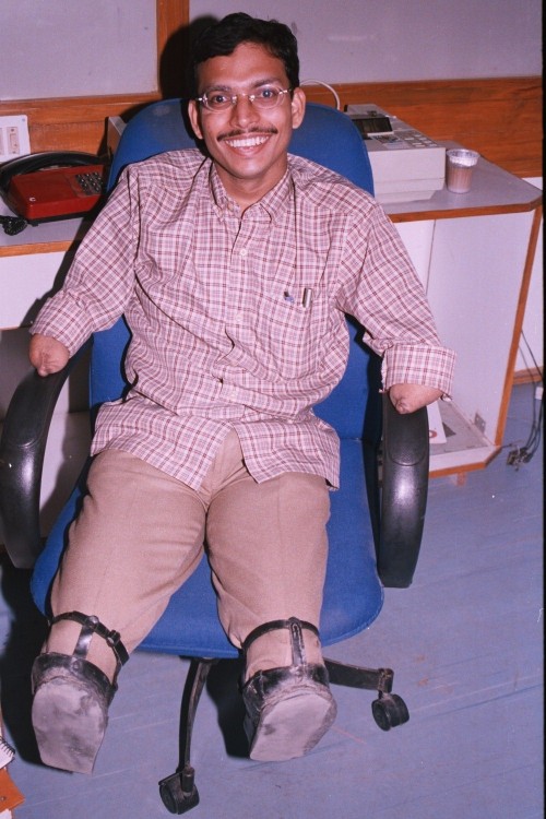 Raja is always smiling despite the fact that he lost all his limbs at the age of 5