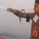 shivkumar-prosthetic-limb-helping-hands