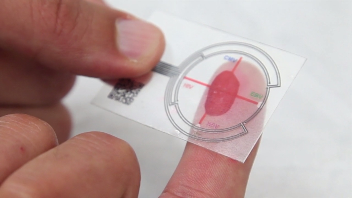 HIV testing device