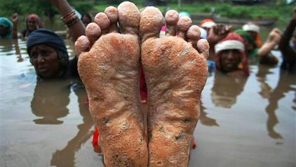 The feet of a protestor are displayed during the Jal Satyagraha at Ghogal in Khandwa MP. 