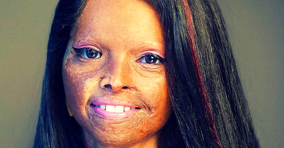 [VIDEO] This Ad Featuring an Acid Attack Survivor Will Make You Rethink the Meaning of Beauty