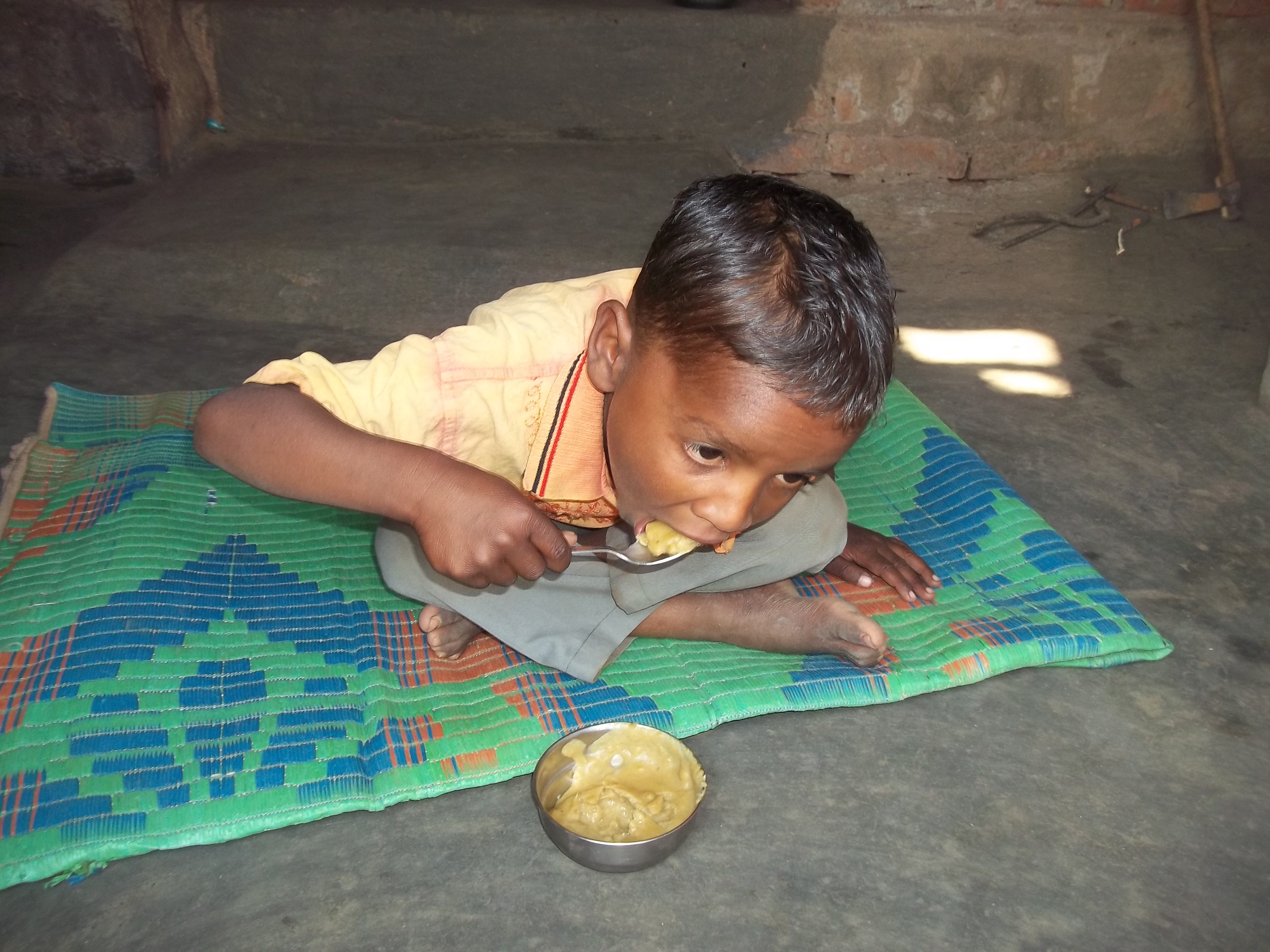 This is Pramod Majhi, whose mother Pramila ensures that she gives him ‘tiranga bhojan’ for every meal. Thanks to the sustained balanced input he has grown taller, his skin is clearer and his hair is black and thick. (Credit: Saadia Azim\WFS)