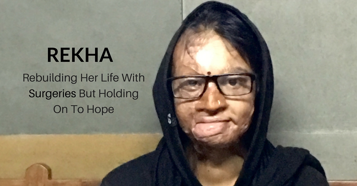 TBI BLOGS: How Acid Attack Survivor Rekha Is Rebuilding Her Life after 6 Painful Surgeries