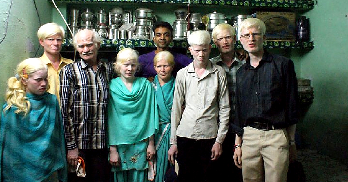 albino indian person