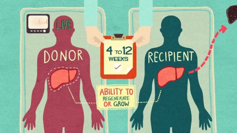 Donate Life: What You Need To Know About Organ Donation In India