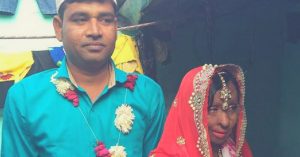 This Acid Attack Survivor's Beautiful Story Shows That Love Conquers All
