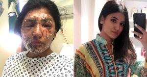 It's What's Beneath the Skin That Counts: Acid Attack Survivors Who Never Backed Down