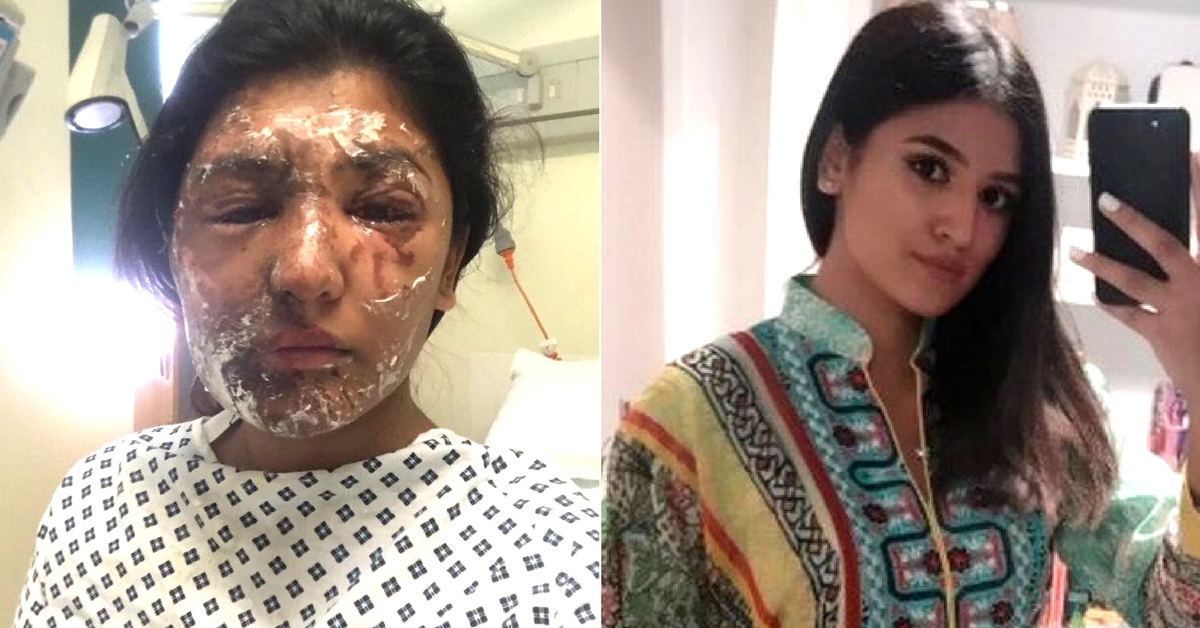 It’s What’s Beneath the Skin That Counts: Acid Attack Survivors Who Never Backed Down