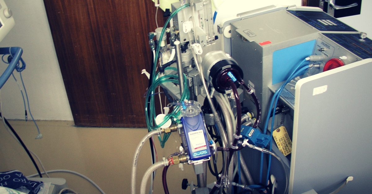 ECMO (Picture for representative purposes only) Picture Credits: Wikimedia Commons.