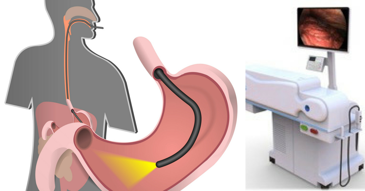 Endoscopy and EndoMimyk