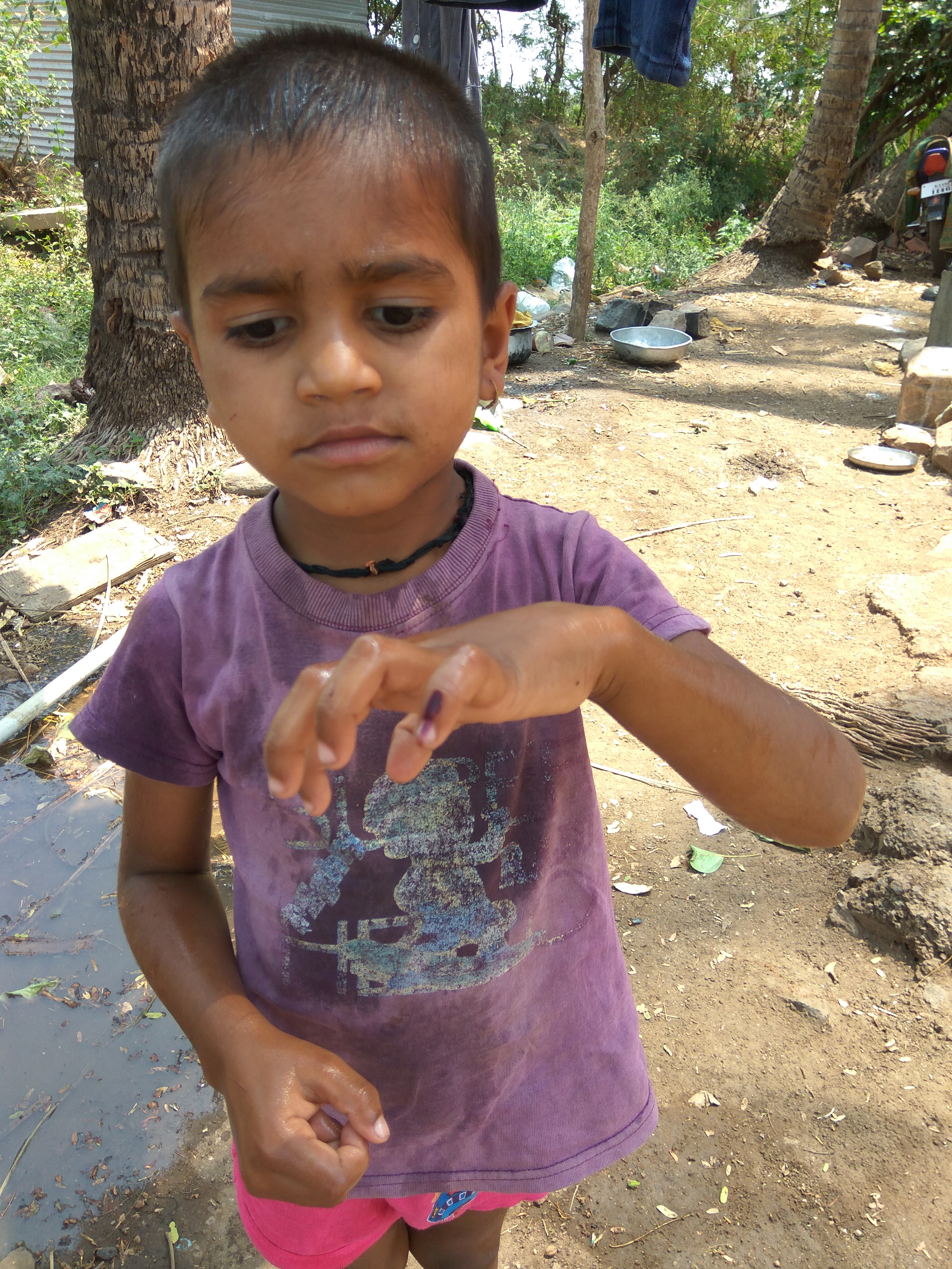 A child showing the indelible mark on her left little finger indicating her positive immunisation status. 