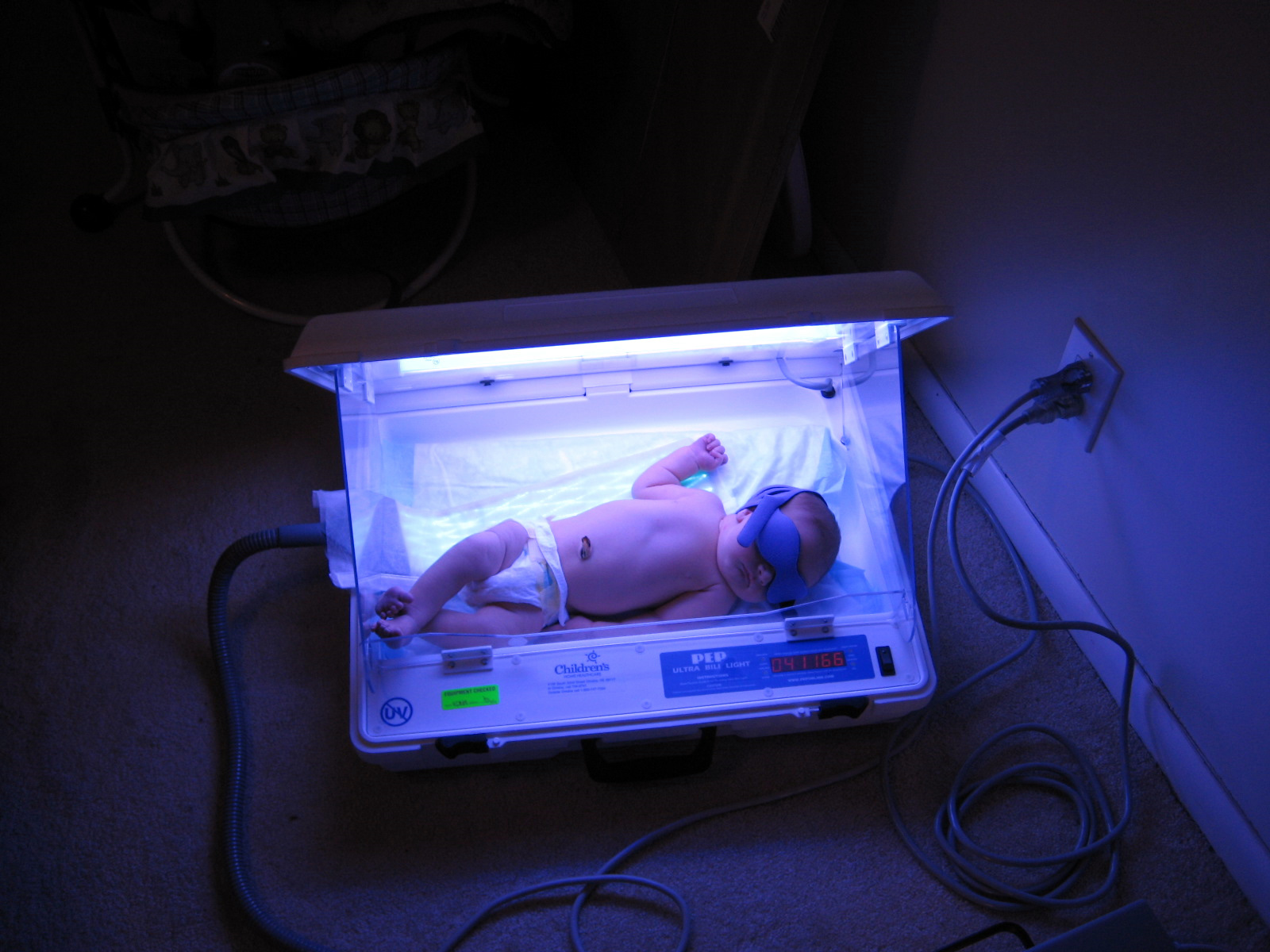 Можно ли лампой. Желтушка у новорожденных фототерапия. УФО лампа для новорожденных при желтухе. Фототерапия гемолитической болезни новорожденных.