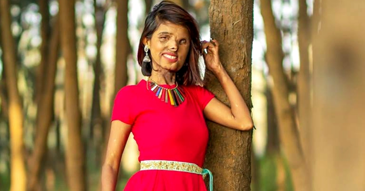 Burnt By Her Dad, Here’s How This Acid Attack Survivor Made Fashion Her Calling