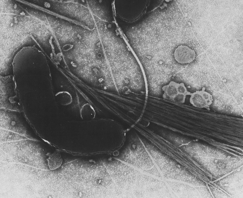 Vibrio cholerae, the bacterium that causes cholera. (Source: Wikimedia Commons)