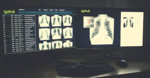 Mumbai Startup's 2-Minute AI Tech Is Revolutionising How India Tackles TB!