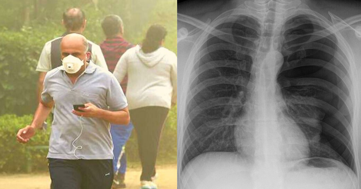 COPD: All you need to know About The Lung Disease That’s Killed Millions in India