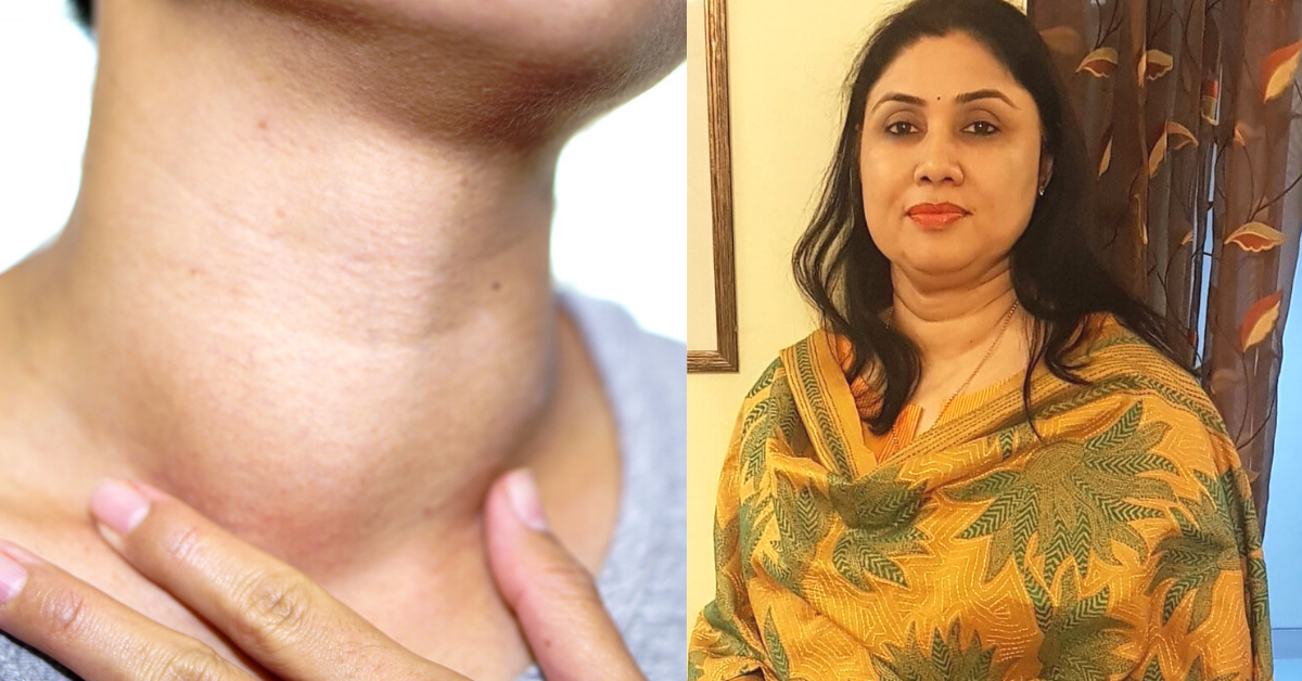 Is Thyroid Making Me Gain Weight? 9 Myths Debunked by a Doctor