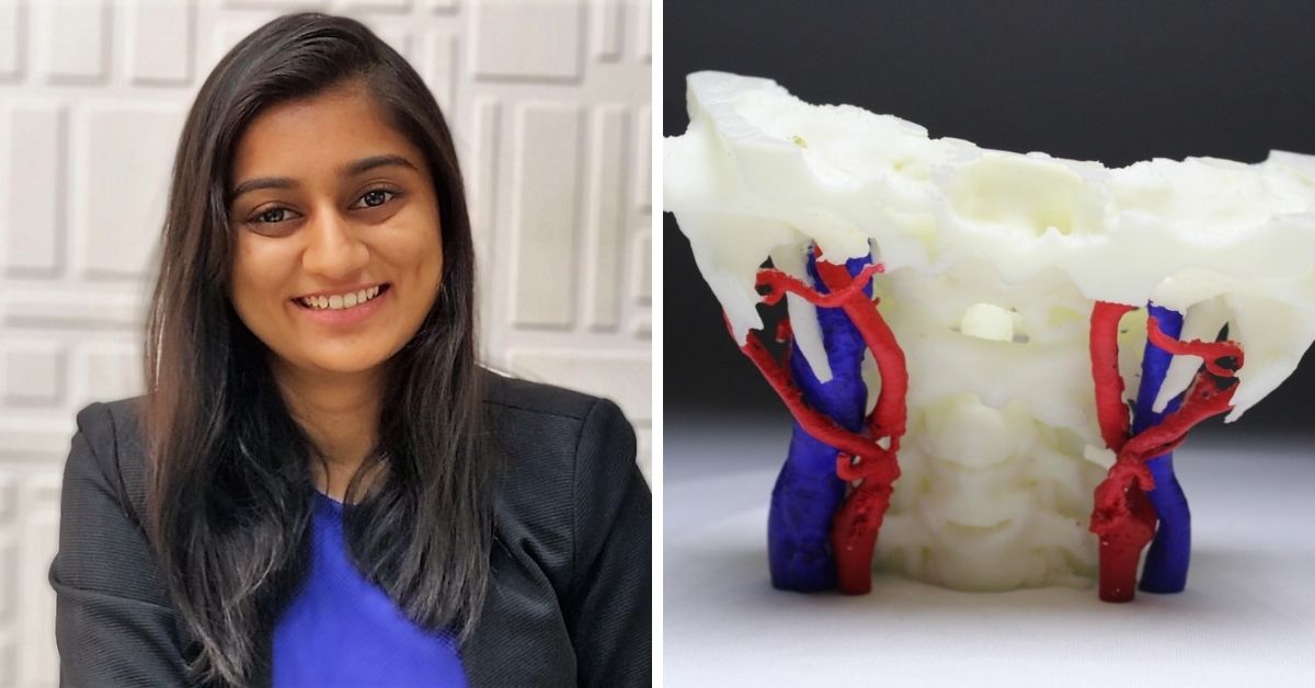 Mumbai Startup 3D Prints Bones Starting at Rs 5,000; Aids Over 1200 Surgeries