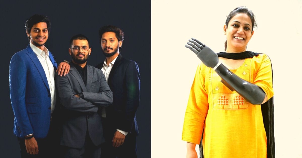 Inspired by Dr Kalam, Hyd Innovator Builds Lightweight Bionic Hand At 1/10 The Cost