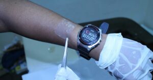 Monitor Blood Sugar Through Sweat, Using PhD Scholar's Biodegradeable Skin Patch