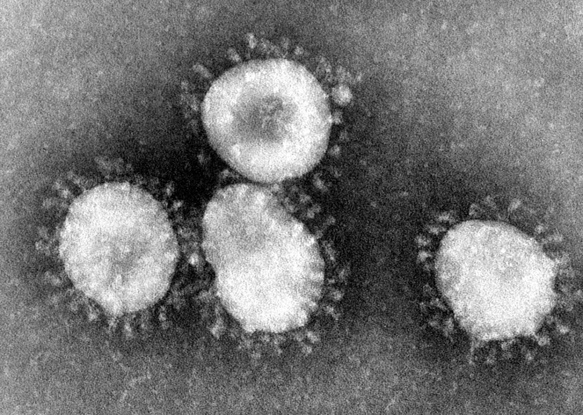 coronavirus strain