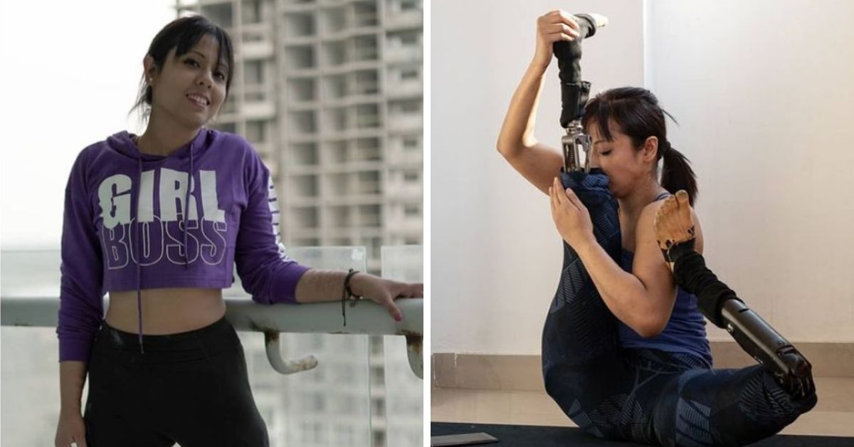 ‘I Became a Yoga Teacher After Losing Both Legs’: Inspiring Double Amputee Speaks