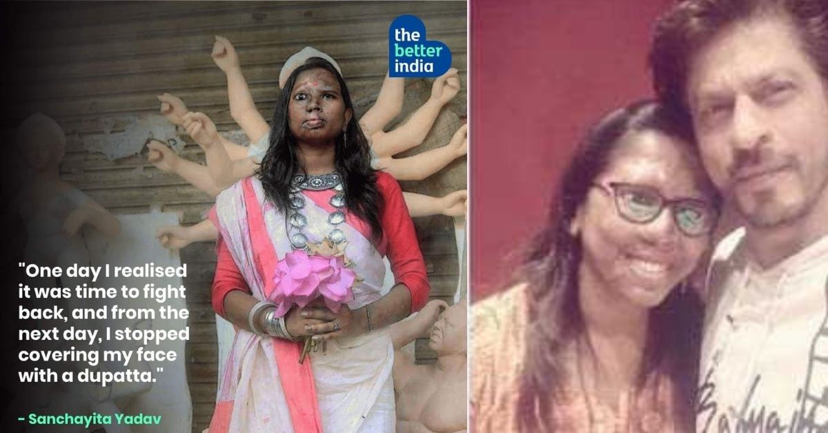 Durga Acid Attack Survivor