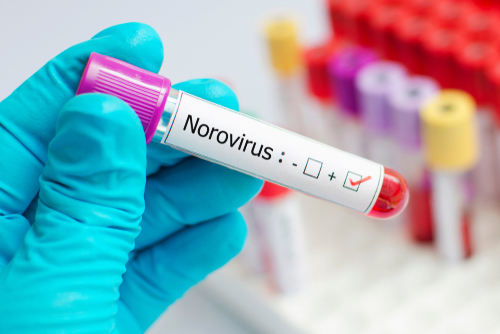 Norovirus in Kerala: How It Spreads & What You Need to Know to Protect Yourself