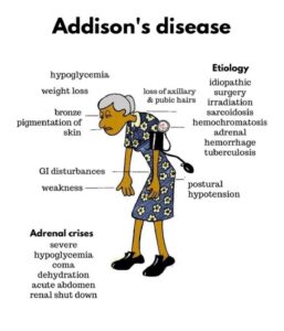 Dr Gohari's mnemonics