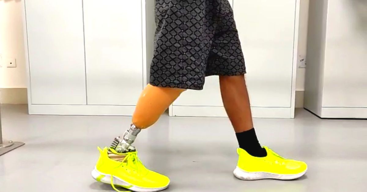IIT Guwahati Prosthetic Leg
