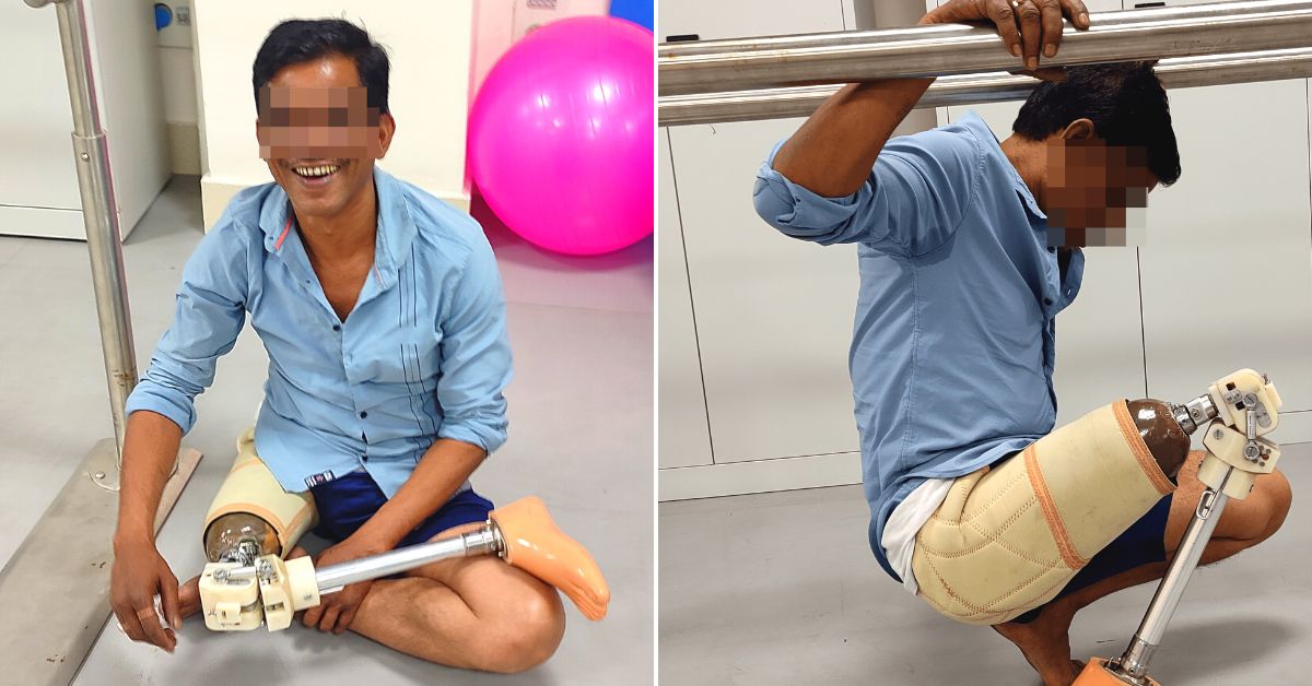 IIT-G’s Prosthetic Leg Allows Disabled to Use Indian-Style Toilets, Perform Yoga