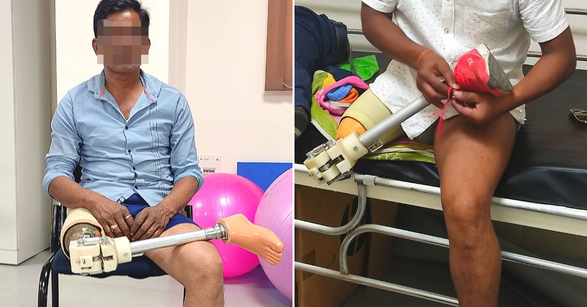 A beneficiary wearing the Prosthetic Leg developed by IIT-G  designed it specifically for Indian conditions (Image courtesy IIT-Guwahati)