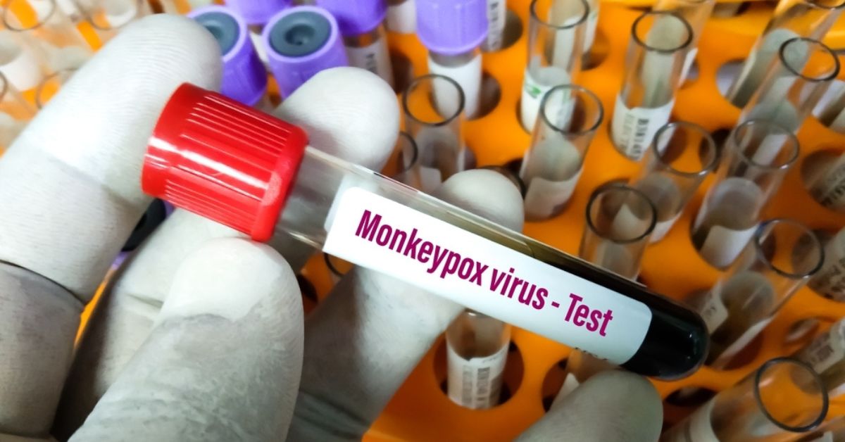 a vial containing tests for monkeypox first case announced in india