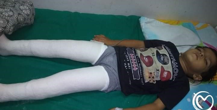 Seorang anak menjalani operasi melalui Madhuram Charitable Trust