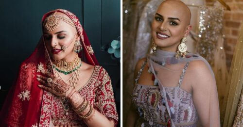 ‘Who Would Marry a Bald Indian Bride?’ Living With Alopecia, I Decided to Ditch the Wig