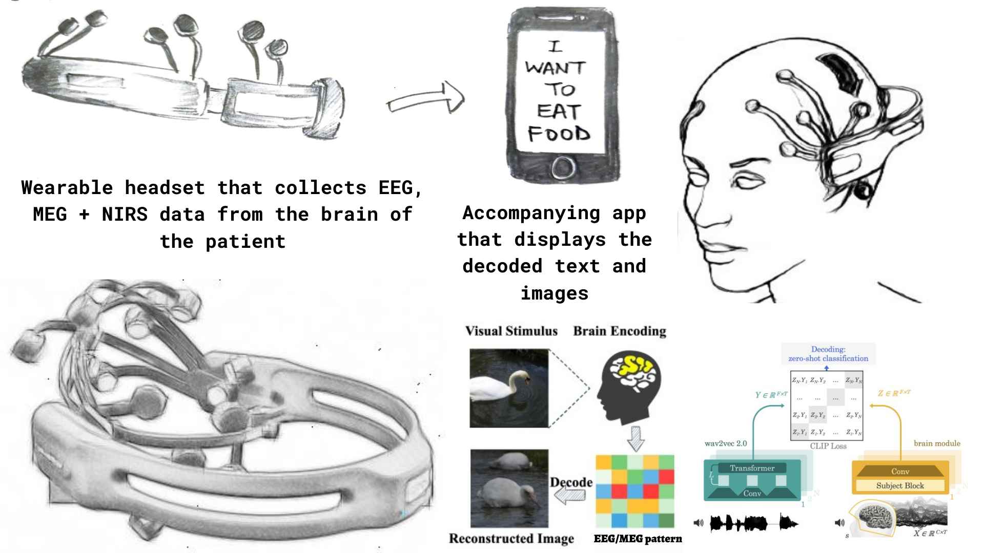 A diagrammatic representation of how NeuroSight works