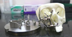 IIT-M Gives Free 3D-Printed Face Implants To Poor Patients Disfigured by Black Fungus