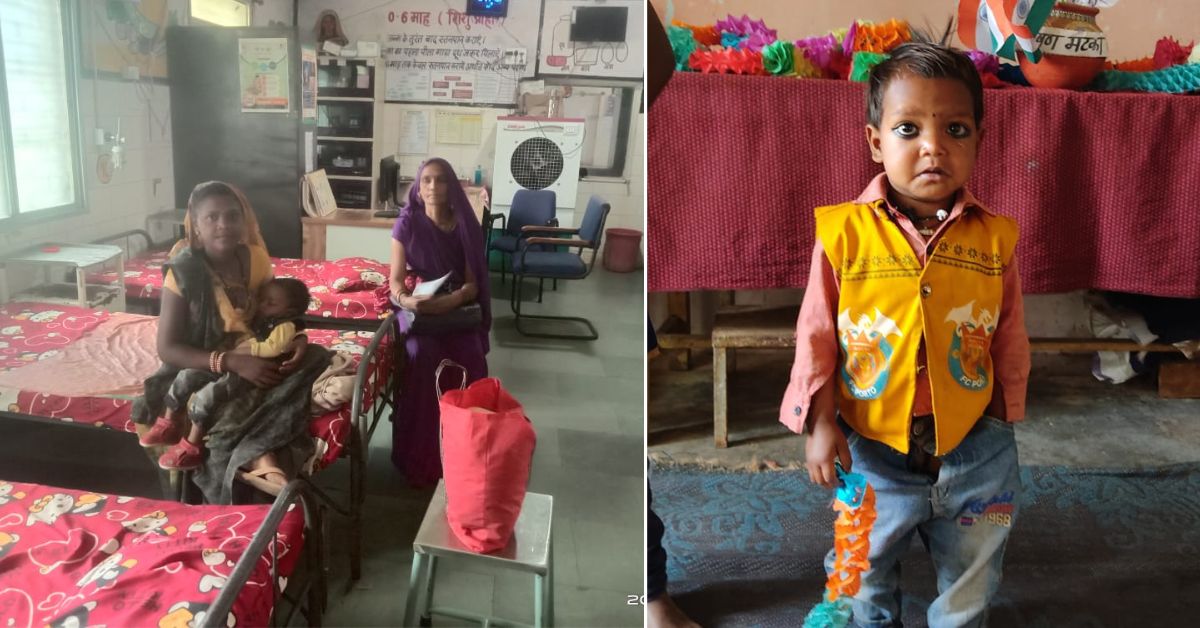 Deepanshu before and after receiving the treatment and nutritional care.